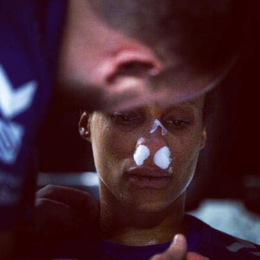 Allison Pineau imediat după momentul accidentării FOTO Instagram 4 handbaliste importante ratează Campionatul European de Handbal feminin după accidentări grave în ultimele zile!