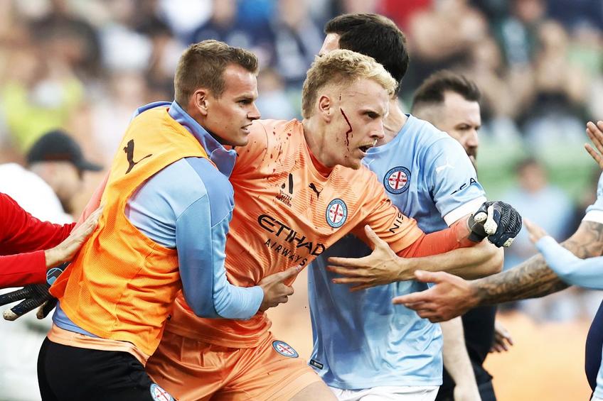 Goalkeeper-ul Tom Glover, după ce a fost atacat de suporterii adverși / foto: Guliver/Getty Images
