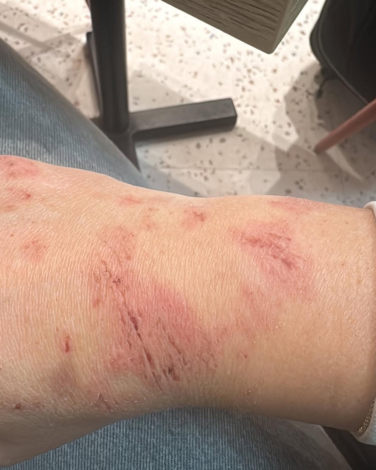 Letizia Paternoster, „căzătură grea” suferită în timpul presezonului din Spania. Foto: Instagram