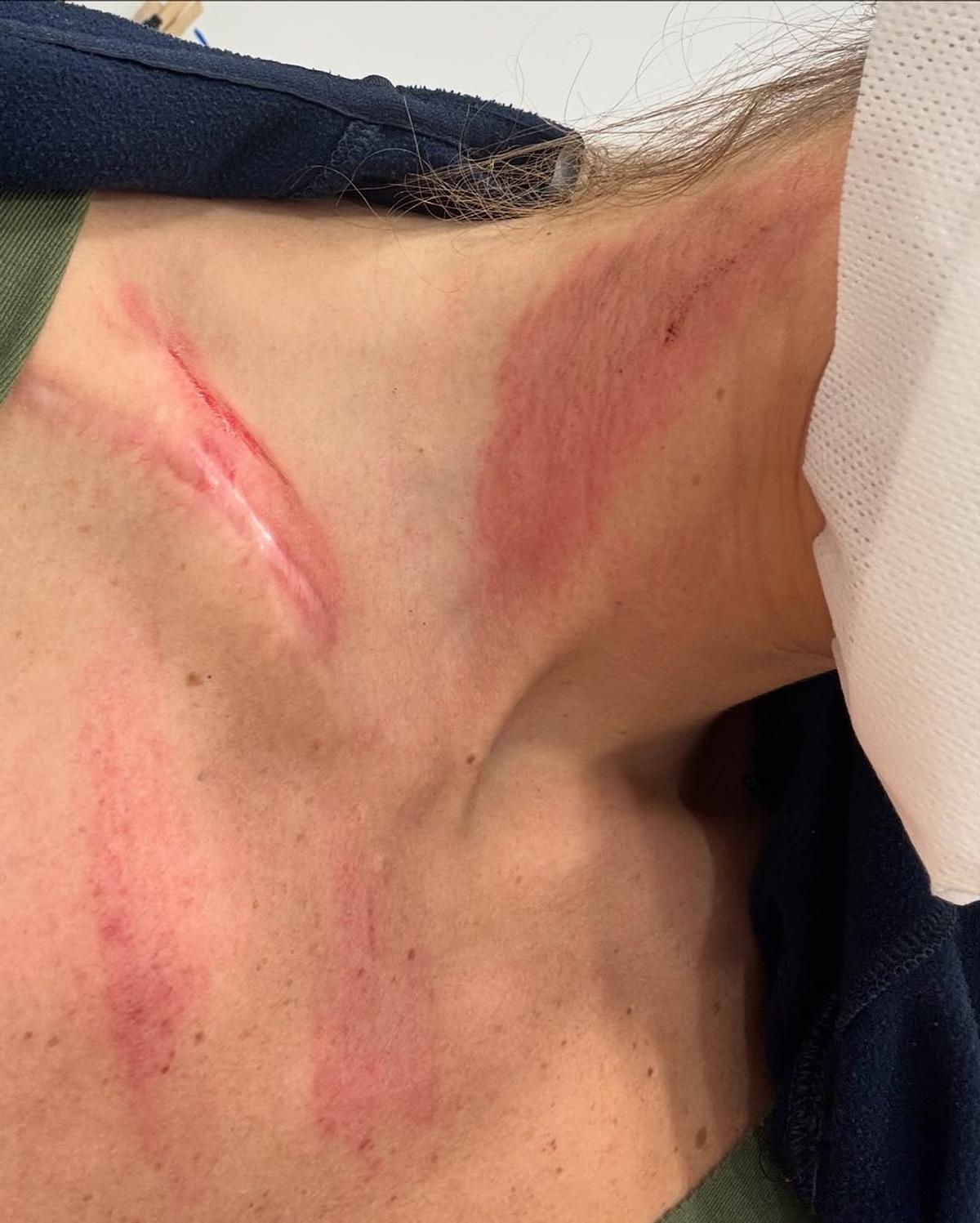Letizia Paternoster, „căzătură grea” suferită în timpul presezonului din Spania. Foto: Instagram