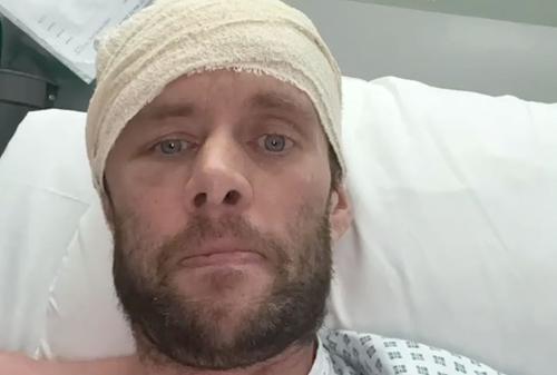 David Smith, după ce a fost operat pe creier // foto: Instagram