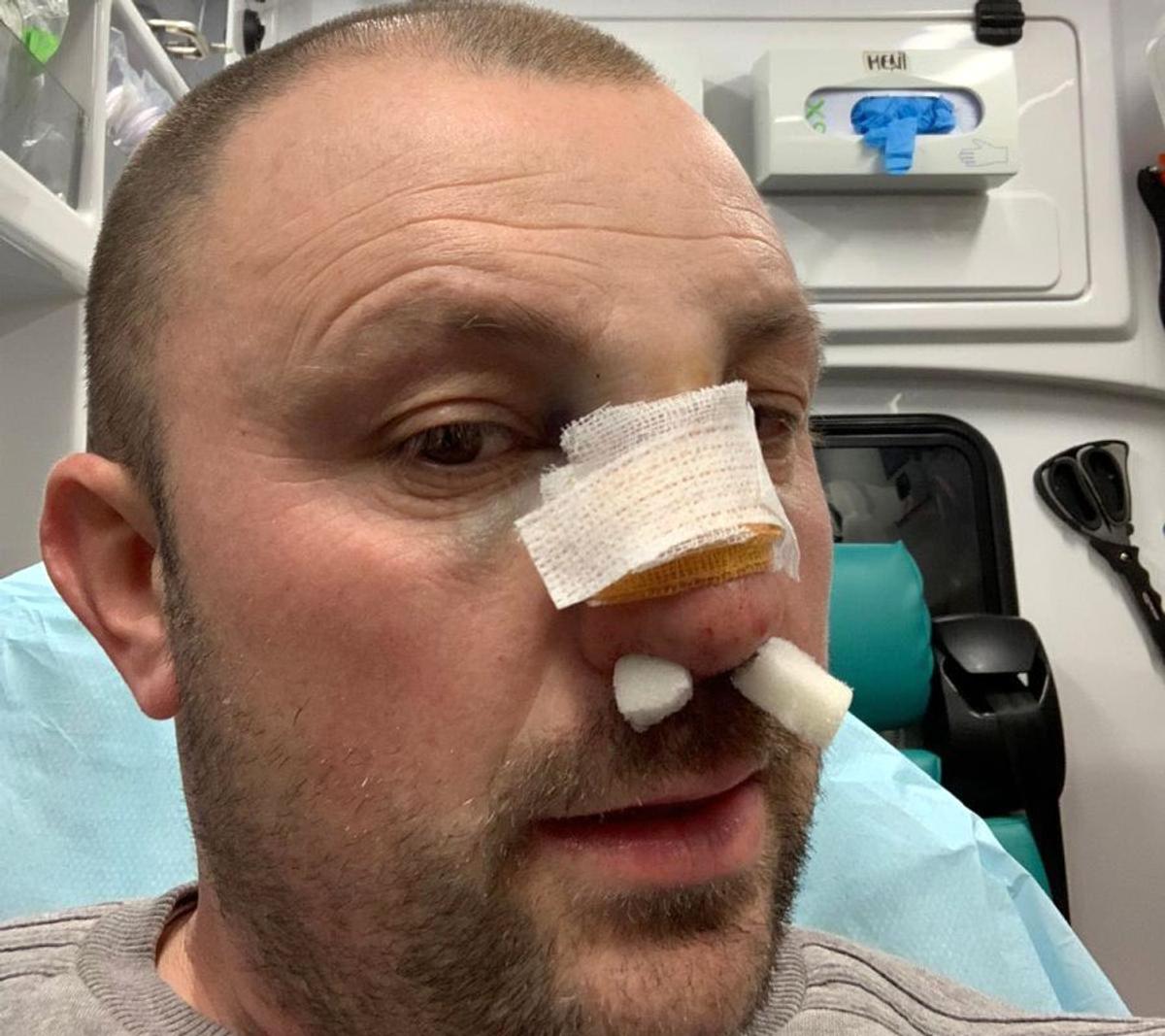 Fostul kickboxer Mihai Oprea, bătut de Vitalie Bîrza în plină stradă