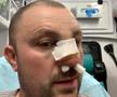 VIDEO EXCLUSIV Fost kickboxer român, snopit în bătaie în plină stradă de un fost pugilist: „A încercat să mă înjunghie!”