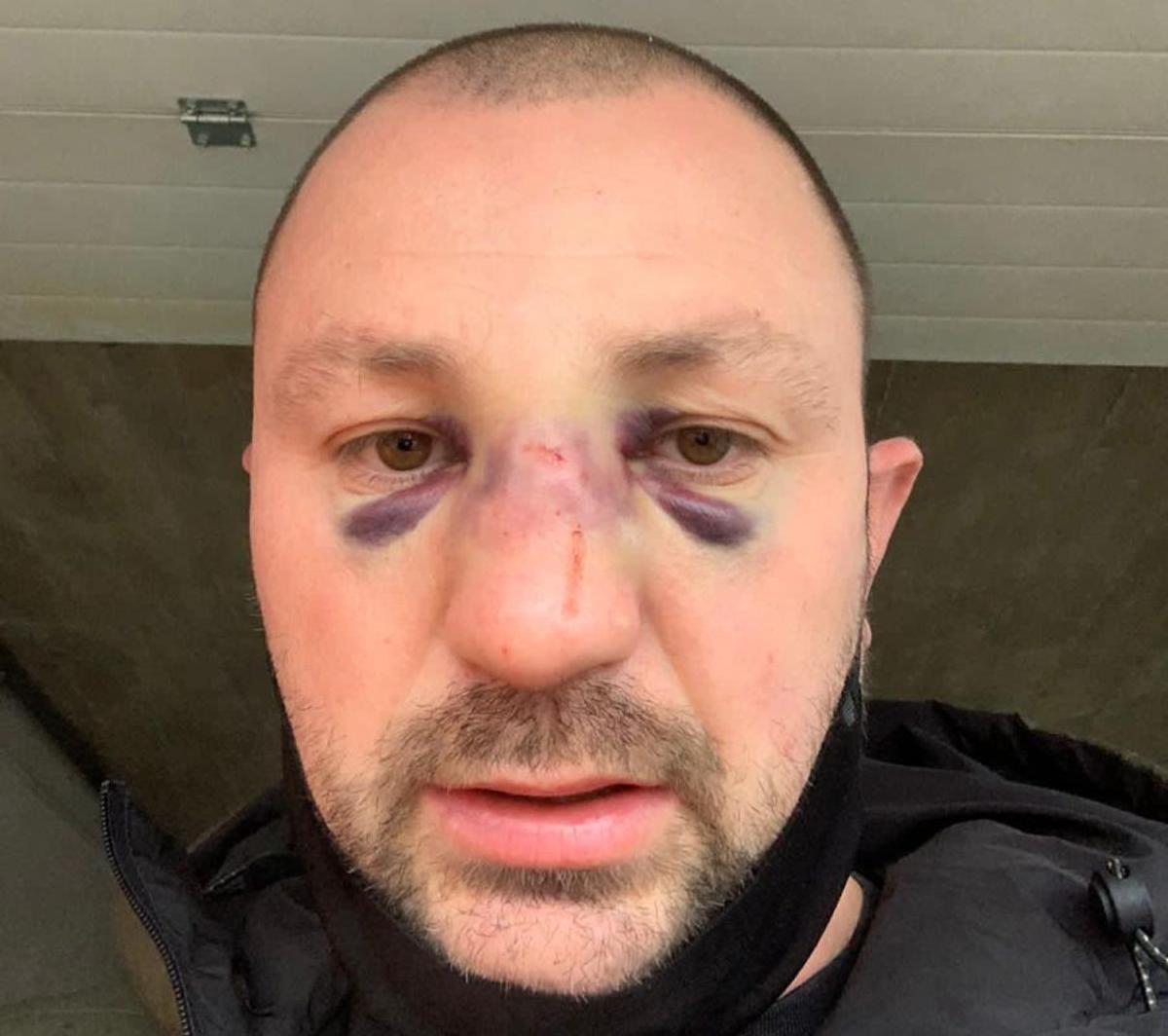 Fostul kickboxer Mihai Oprea, bătut de Vitalie Bîrza în plină stradă