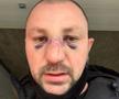VIDEO EXCLUSIV Fost kickboxer român, snopit în bătaie în plină stradă de un fost pugilist: „A încercat să mă înjunghie!”
