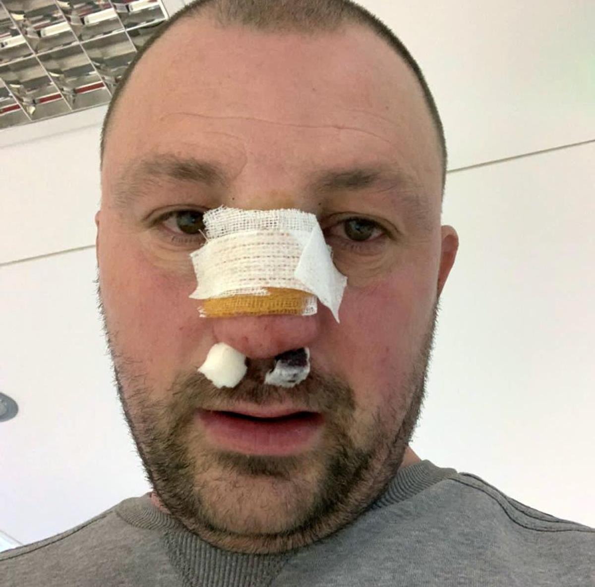 VIDEO EXCLUSIV Fost kickboxer român, snopit în bătaie în plină stradă de un fost pugilist: „A încercat să mă înjunghie!”
