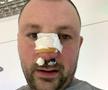 VIDEO EXCLUSIV Fost kickboxer român, snopit în bătaie în plină stradă de un fost pugilist: „A încercat să mă înjunghie!”