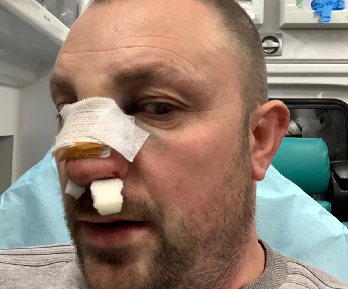 VIDEO EXCLUSIV Fost kickboxer român, snopit în bătaie în plină stradă de un fost pugilist: „A încercat să mă înjunghie!”