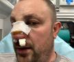 VIDEO EXCLUSIV Fost kickboxer român, snopit în bătaie în plină stradă de un fost pugilist: „A încercat să mă înjunghie!”