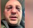 Fostul kickboxer Mihai Oprea a fost bătut de Vitalie Bîrza în plină stradă