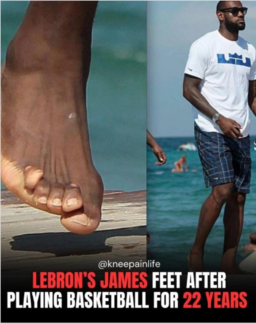 Au îngrozit planeta! » Ce se întâmplă cu picioarele lui LeBron James?