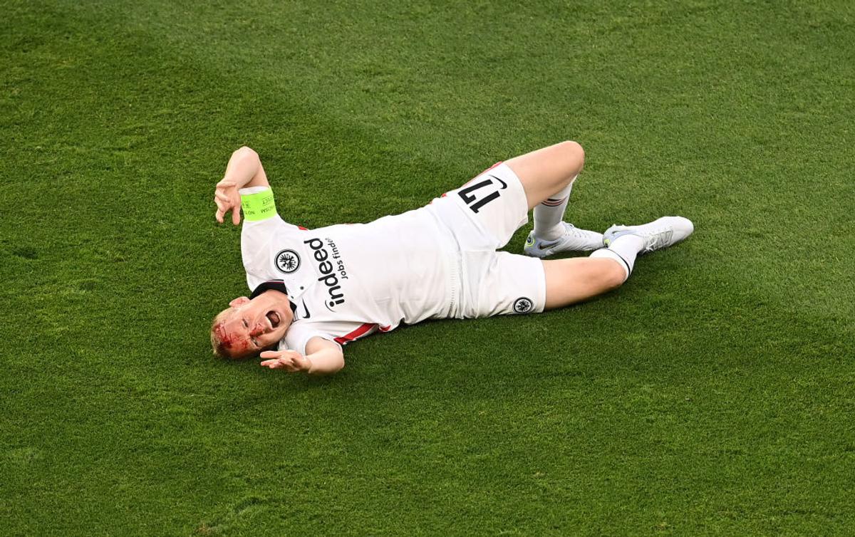 Rode, accidentat serios în Eintracht Frankfurt - Rangers