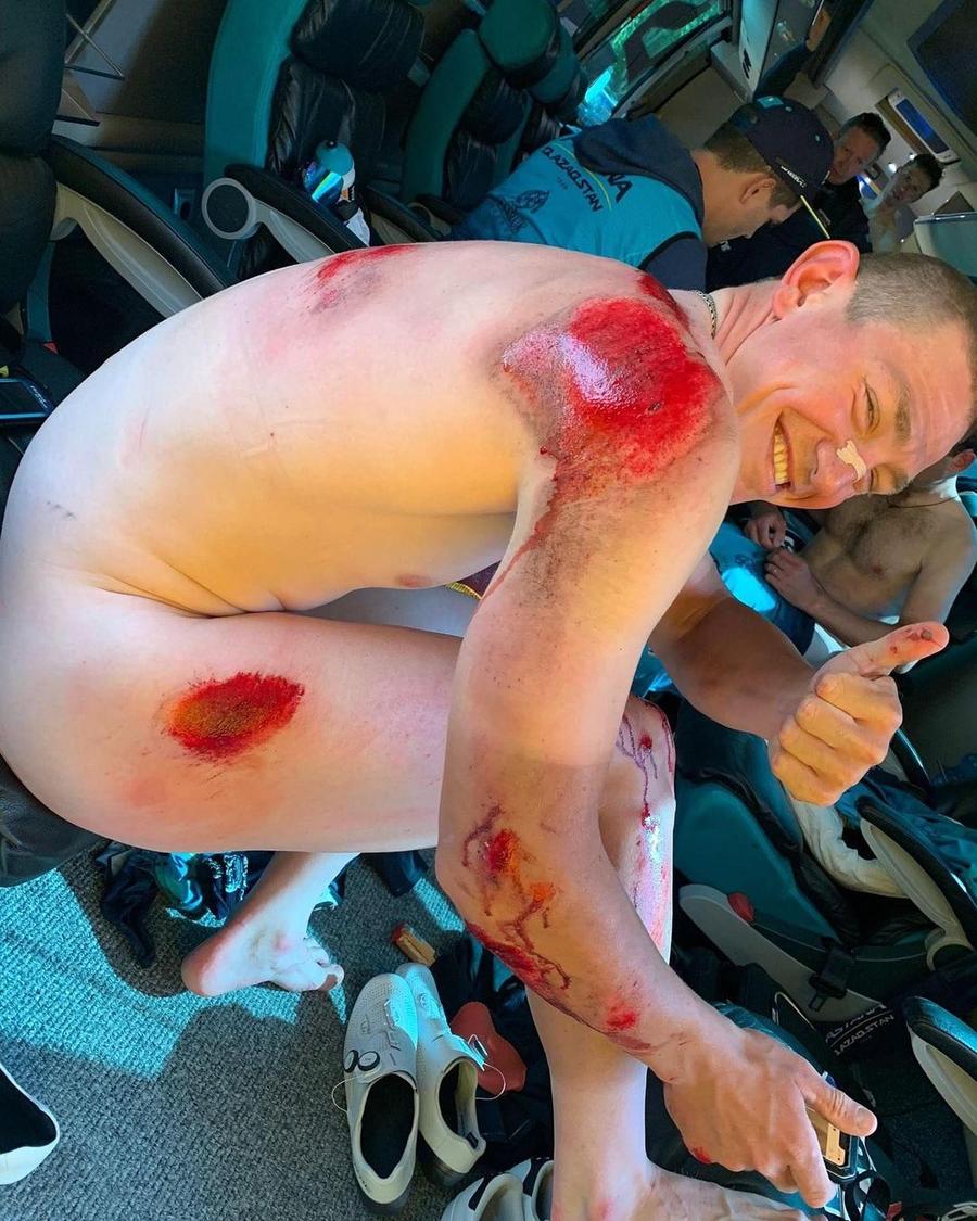 Sursă foto: Instagram @glebsyritsafanpage Imagini sensibile la o cursă din Franța » Un ciclist rus a suferit o accidentare teribilă! Plin de sânge pe coate, genunchi, umăr și coapsă
