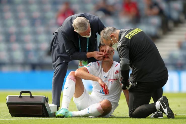 Năprasnicul Patrik Schick a oferit imaginea zilei la EURO 2020. Sursă foto: Imago Images