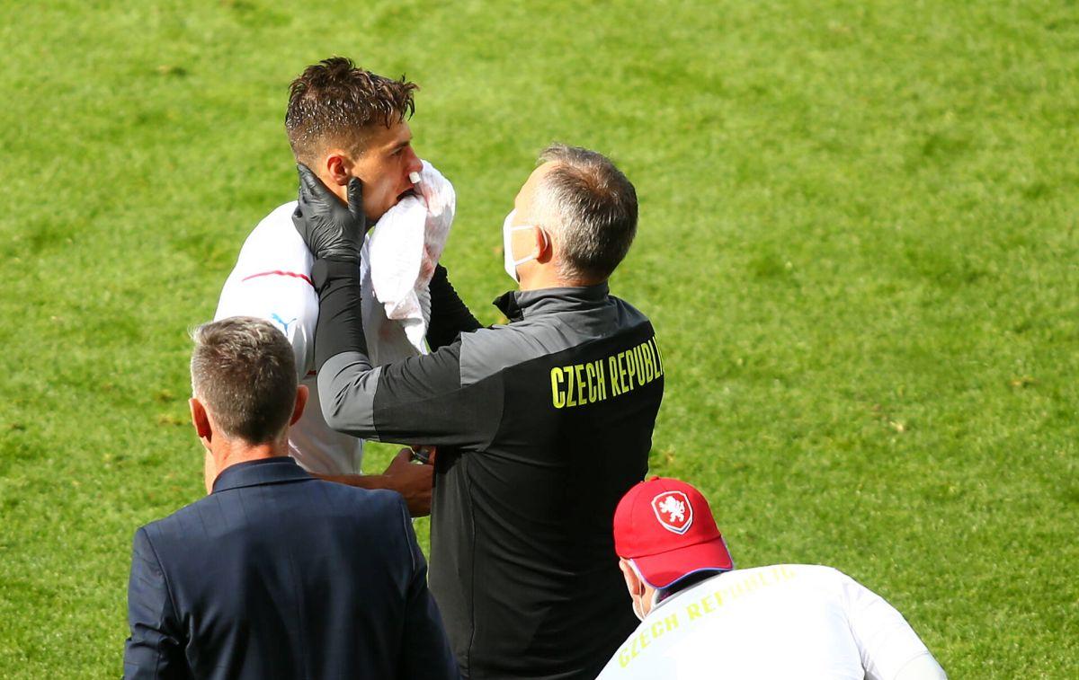 Sânge și sudoare-n iarbă! Năprasnicul Patrik Schick a oferit imaginea zilei la EURO 2020