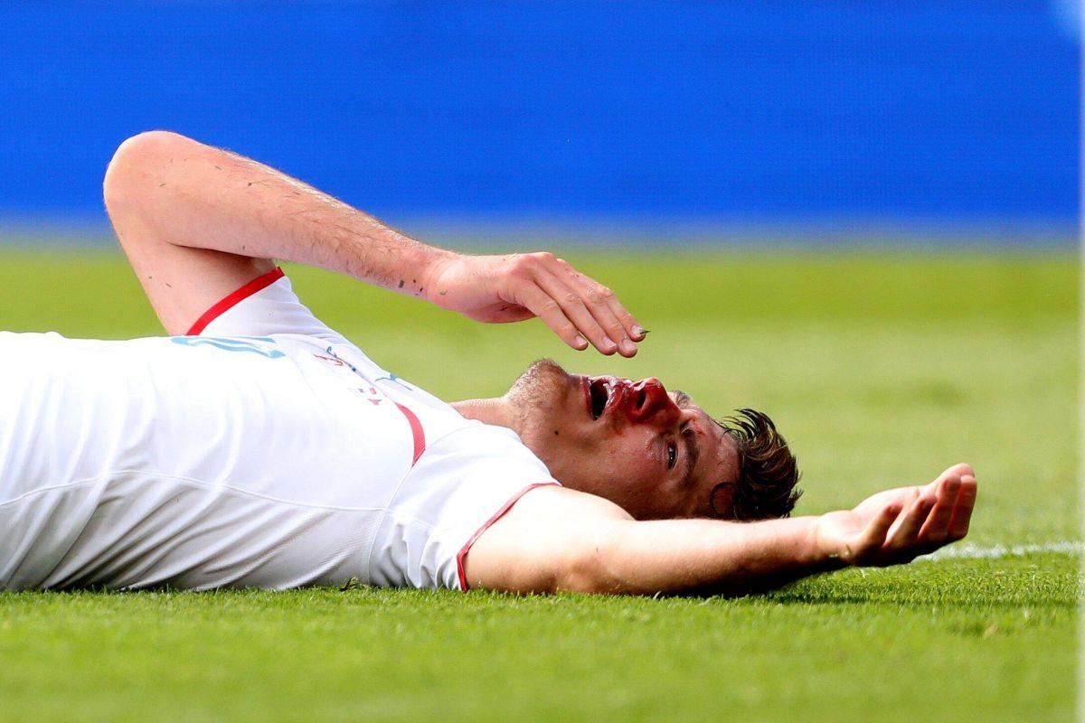 Moment incredibil la Euro 2020 » Eroul Cehiei, plin de sânge la faza golului