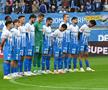 Universitatea Craiova - Unirea Slobozia / Foto: sportpictures