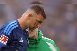 Edin Dzeko, rană deschisă la cap!  » Medicul a cerut înlocuirea