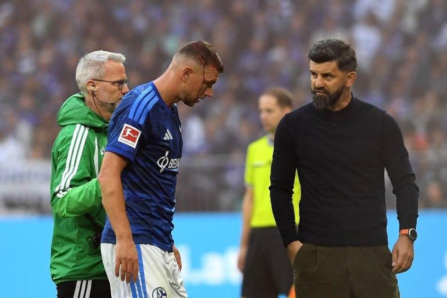 Edin Dzeko, la ieșirea de pe teren / Foto: X Edin Dzeko, rană deschisă la cap! » Medicul a cerut înlocuirea