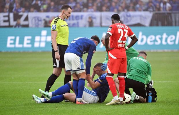Edin Dzeko, rană deschisă la cap!  » Medicul a cerut înlocuirea