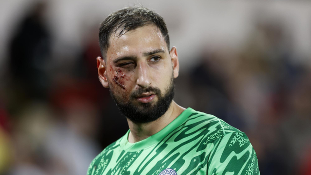 Diagnosticul primit de Gianluigi Donnarumma și o imagine tulburătoare: i-au aplicat de urgență 10 copci!