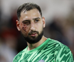 Accidentare HORROR suferită de Gianluigi Donnarumma » Adversarul l-a lovit cu talpa direct în figură, dar n-a primit niciun avertisment!