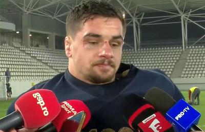 Imagini de impact » Cu ochiul tumefiat și buza spartă, căpitanul României vorbește printre lacrimi și suspine: „Dacă nu se poate cu vorbă bună...”