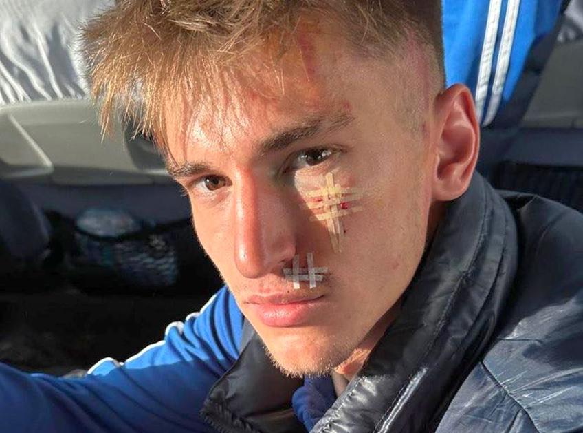 Așa arată Cătălin Itu după intervenția brutală a lui Ghiocel / Sursă foto: Instagram