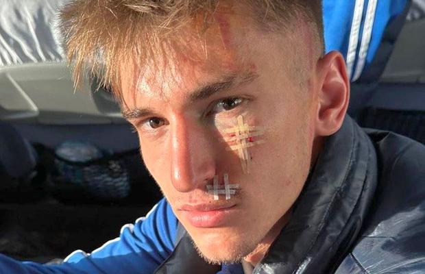 „Incalificabil! Ce intervenție inconștientă!” » Căpitanul Oțelului, eliminat direct după o intrare HORROR cu Poli Iași