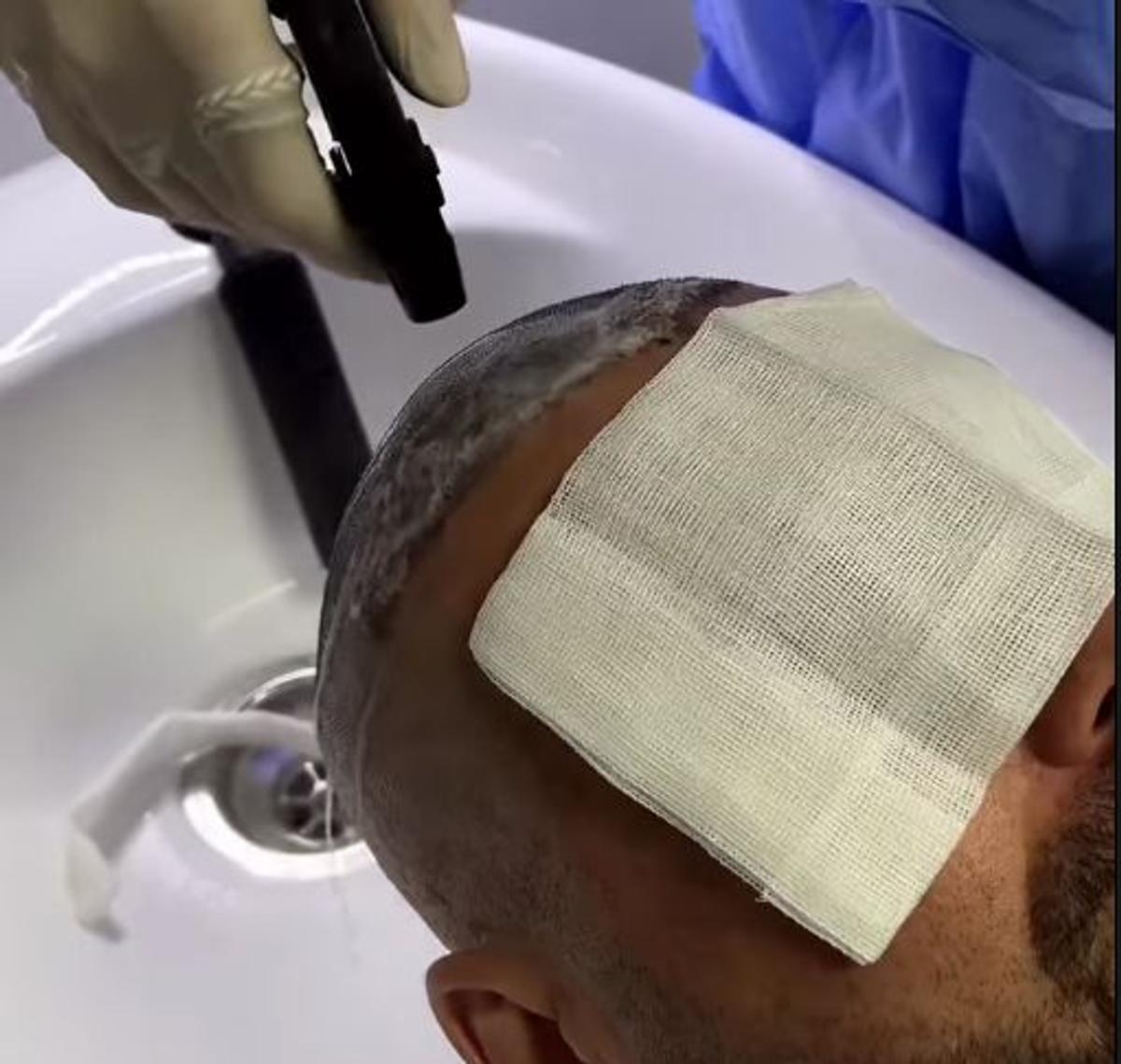 Adrian Mutu, la prima apriție publică după ce și-a făcut implant de păr