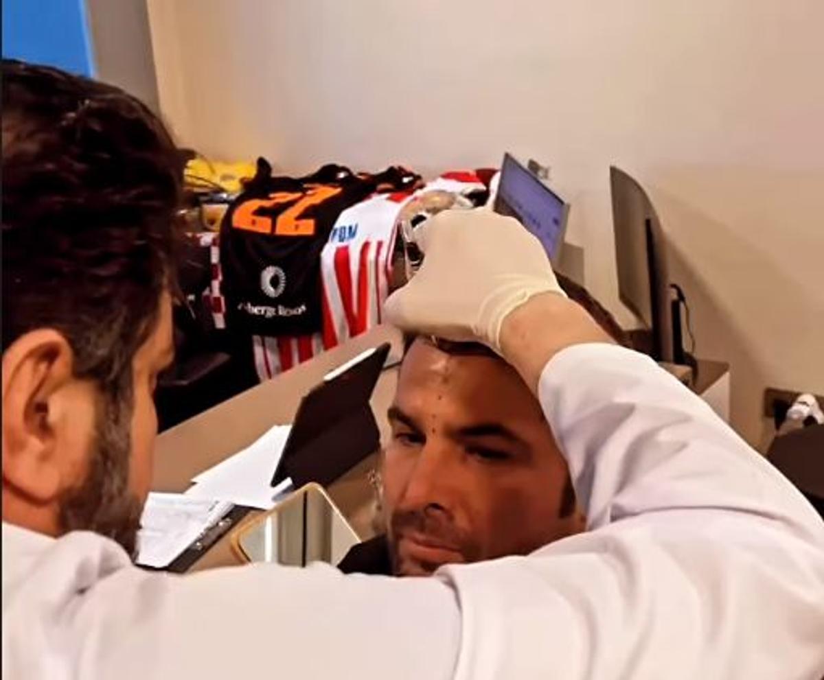 Adrian Mutu și-a făcut implant de păr