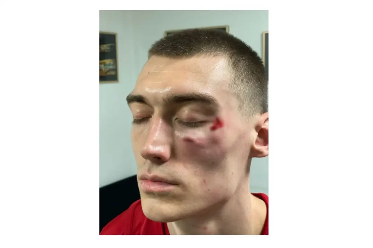Scene scandaloase înaintea derby-ului de diseară » Jucătorii s-au luat la bătaie la vestiare! Se cere intervenția Ministerului de Interne: „Vătămare corporală gravă!