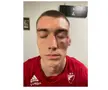 Scene scandaloase înaintea derby-ului de diseară » Jucătorii s-au luat la bătaie la vestiare! Se cere intervenția Ministerului de Interne: „Vătămare corporală gravă!