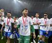 Campionii de la Craiova au imitat trendul cu ochelarii de soare