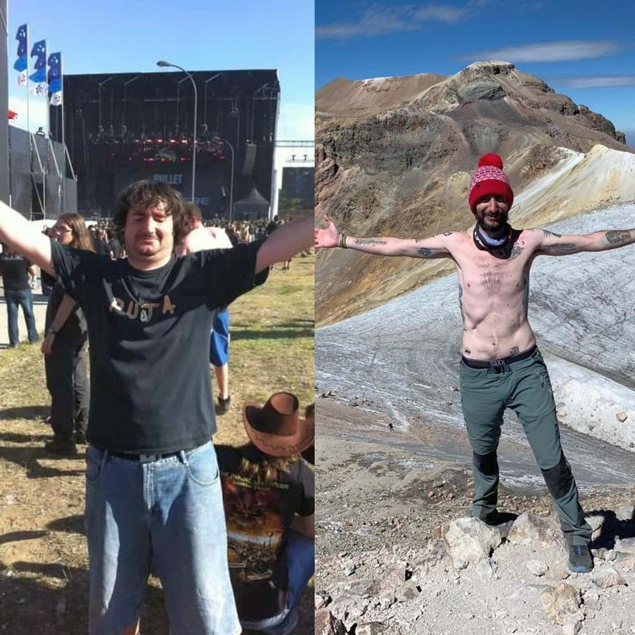 Juan, înainte și după operații (foto: Instagram) Juan, maratonistul fără stomac, vezică și colon. Campioană europeană între ședințele de chimioterapie + Surpriză pentru Diego