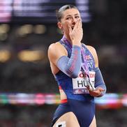 Amy Hunt / FOTO: Imago