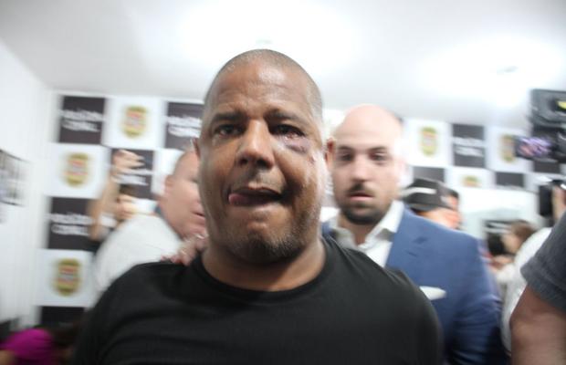 Fostul internațional brazilian care a fost răpit șochează: „A fost o înscenare! Mi-au pus pistolul la cap în tot acest timp”