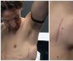 Lui Tom Lockyer i-a fost montat un defibrilator
