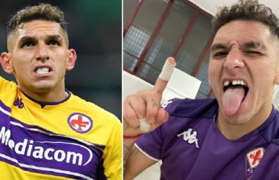 Imaginea zilei în Serie A » Un jucător a rămas știrb după Inter - Fiorentina: „Un punct în plus, un dinte în minus”