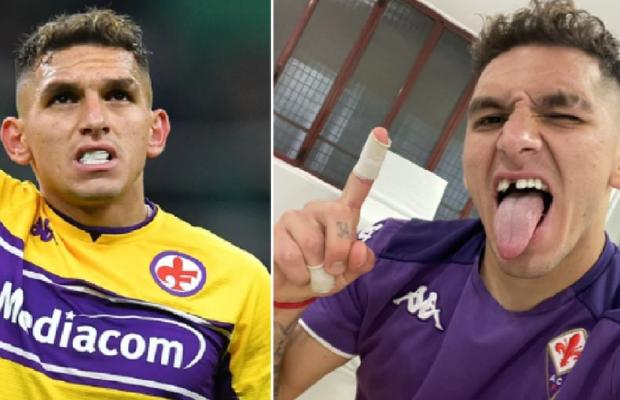 Imaginea zilei în Serie A » Un jucător a rămas știrb după Inter - Fiorentina: „Un punct în plus, un dinte în minus”