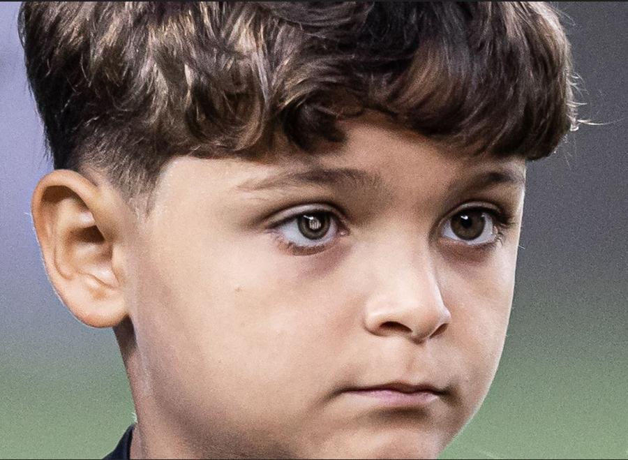 Anthony Milani/ Foto: X Santos Gestul impresionant făcut pentru copilul cu proteză oculară » Fanul și-a imprimat stema clubului pe pupilă!