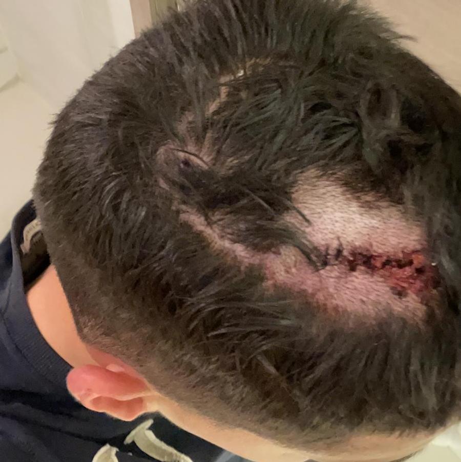Octavian Vâlceanu, după lovitura primită în meciul cu CFR Cluj Gigi Becali a reacționat după dezvăluirea Gazetei: „Probabil că Edi le-a zis asta!”