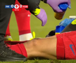 David Miculescu s-a accidentat în Farul - FCSB // FOTO: captură Prima Sport