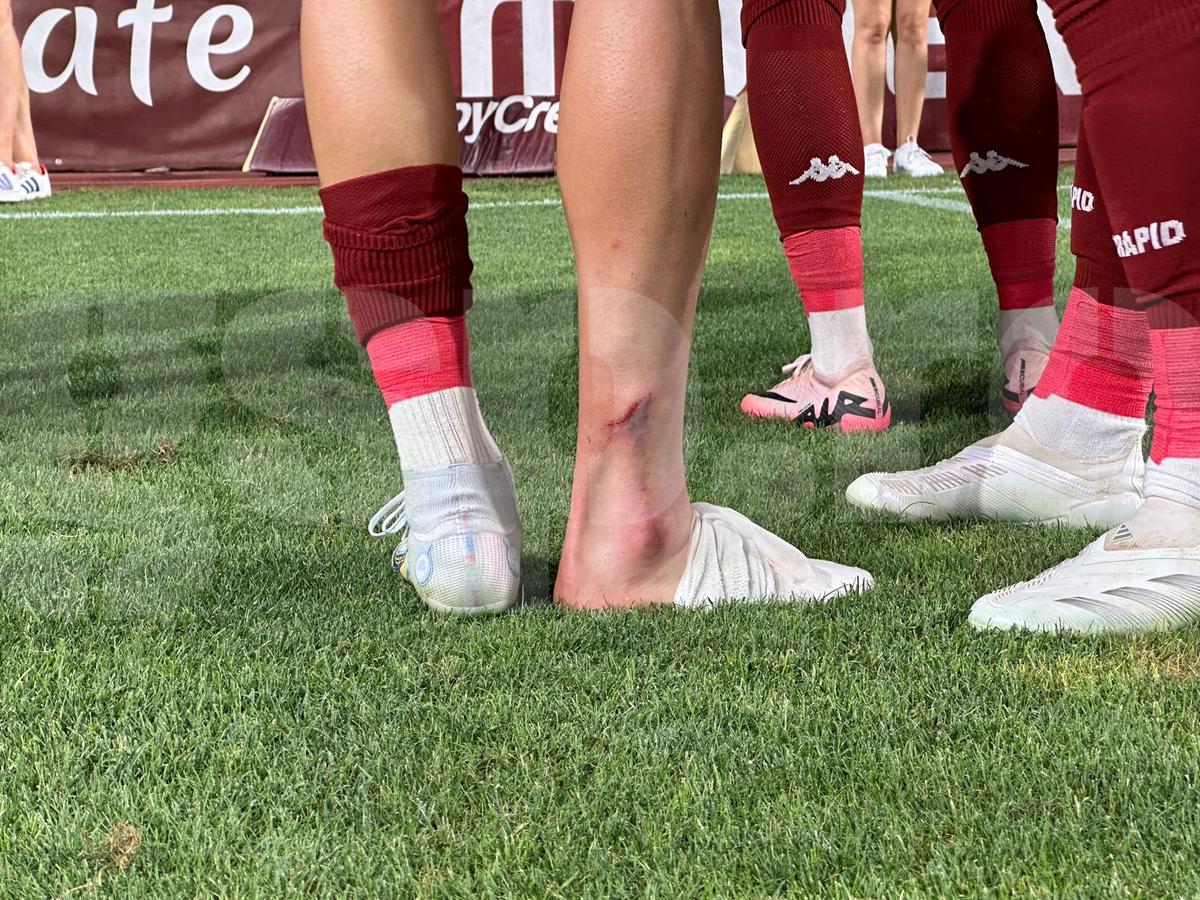 Medicii au anunțat verdictul în cazul lui Albion Rrahmani, ieșit în lacrimi de pe teren în Rapid - CFR Cluj