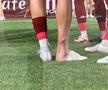 Albion Rrahmani a ieșit accidentat în Rapid - CFR Cluj 2-2. Foto: Ionuț Iordache (GSP)