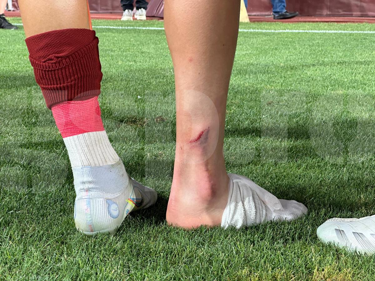 Albion Rrahmani a ieșit accidentat de pe teren