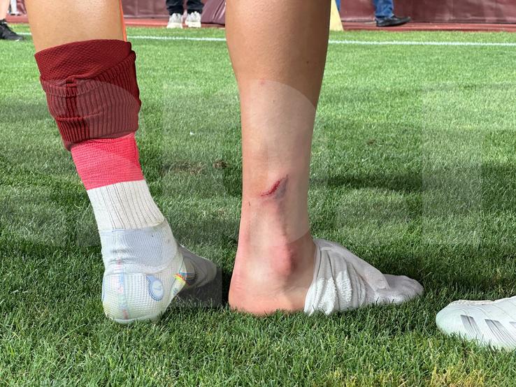 Albion Rrahmani a ieșit accidentat în Rapid - CFR Cluj 2-2. Foto: Ionuț Iordache (GSP)