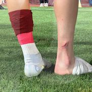 Albion Rrahmani a ieșit accidentat în Rapid - CFR Cluj 2-2. Foto: Ionuț Iordache (GSP)