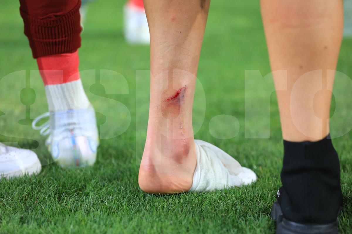 Albion Rrahmani a ieșit accidentat de pe teren