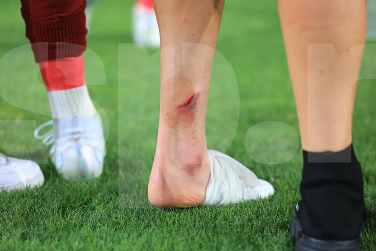 Albion Rrahmani a ieșit accidentat în Rapid - CFR Cluj 2-2. Foto: Ionuț Iordache (GSP)